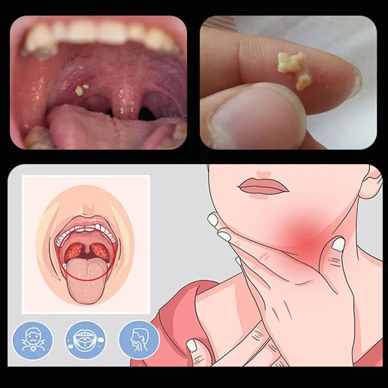 ~Ear Wax Tonsil Stone Remover  - Ear Wax Remover recension och pris
